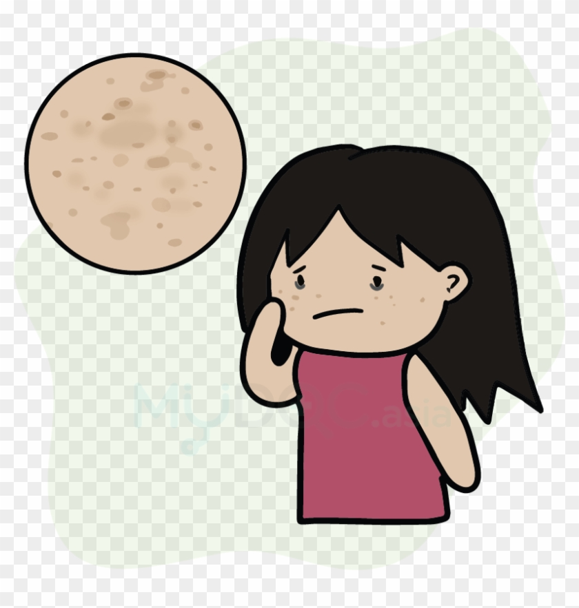 Eye Patch Clipart Translucent - Cartoon - Png Download #2941227