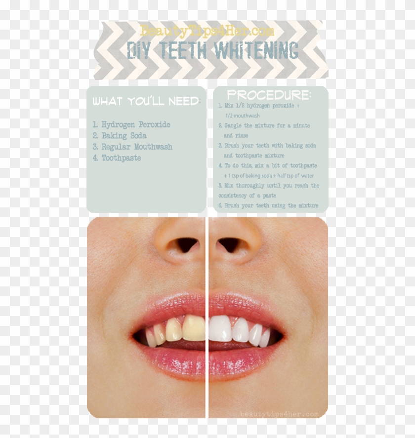 Coco Shine Teeth Png - Teeth Whitening Diy Fast Clipart