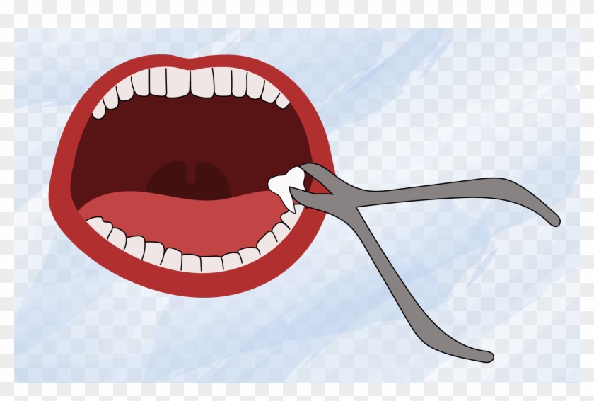 Tooth Clipart Png - Wisdom Teeth Clip Art Transparent Png