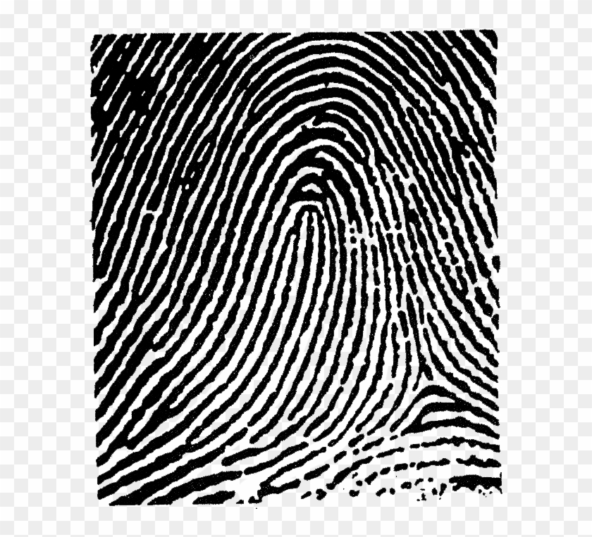 This Image Used For Decorative Purposes Only - Radial Loop On Right Thumb Clipart