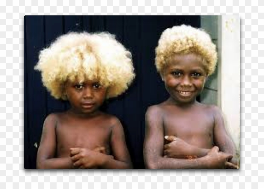 I've Seen Kids With Skin So Dark It Almost Hurts Your - Melanesian Of Solomon Islands Clipart