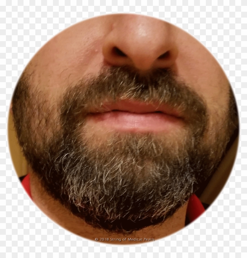 Is This A Reason To Grow A Beard - Close-up Clipart #3019174
