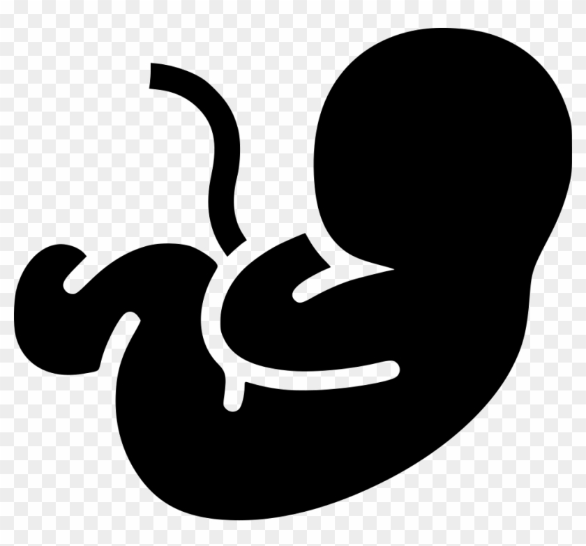 Fetus Pregnancy Pregnant Motherhood Transparent Background - Fetus Png Clipart