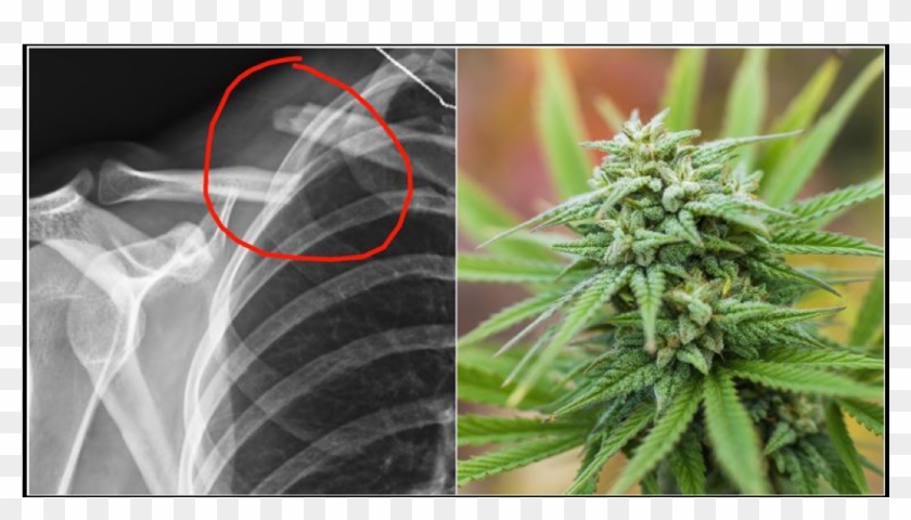 Who'd Of Thought That Smoking A Joint Could Be A Remedy - Marijuana Plants Up Close Clipart