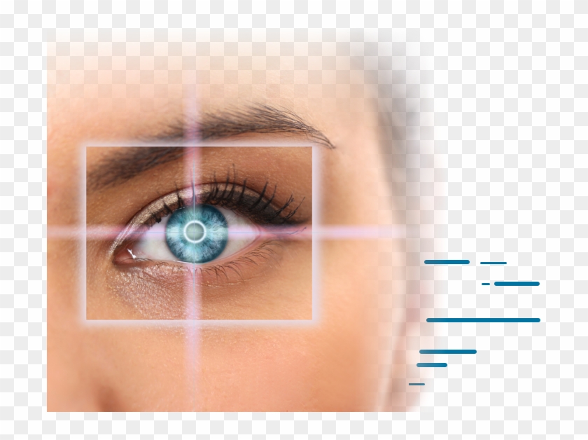 By Using A 100% All-laser Approach, Our Surgeons Can - Lasik Clipart #3103610