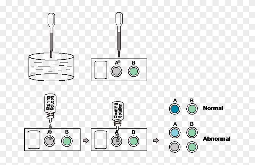 Sperm Concentration Rapid Test Cassette Clipart #3203516