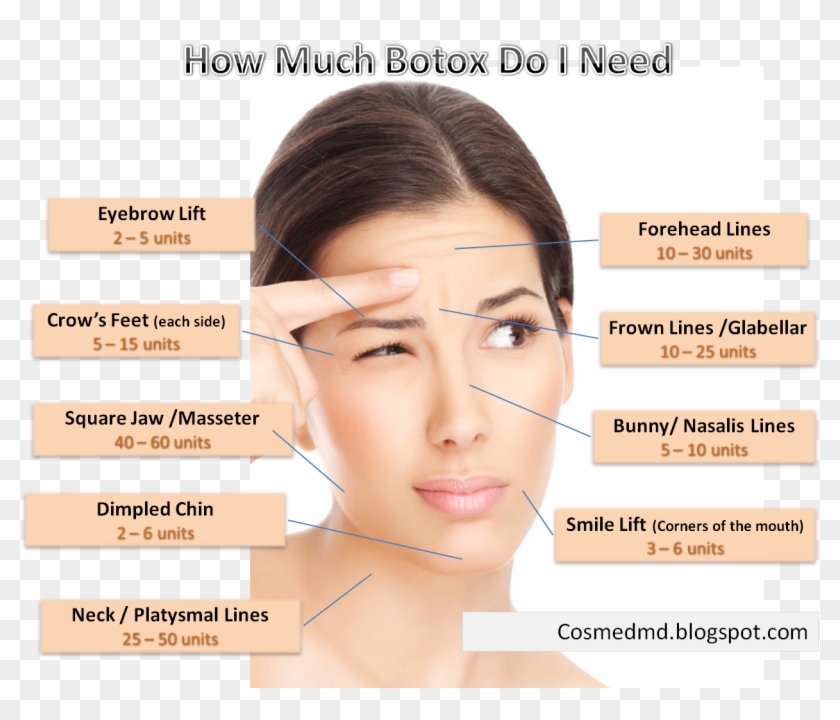 Trump Eyebrows Png - Can You Get Botox On Your Face Clipart