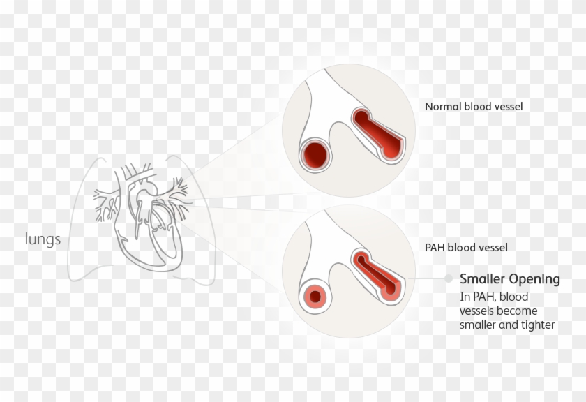 Illustration Clipart #3286099