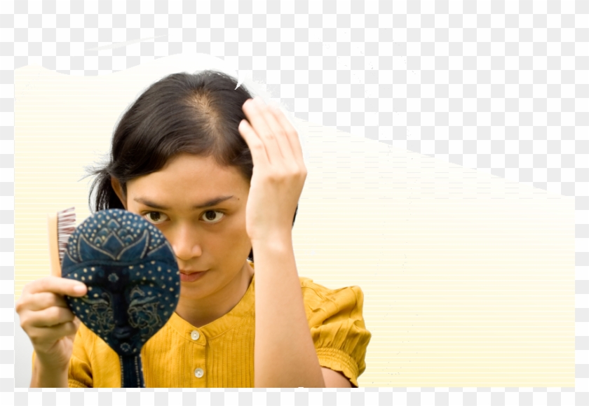 Women Make Up 40% Of Americans With Hair Loss - Beta Blocker Hair Loss Clipart #3294328