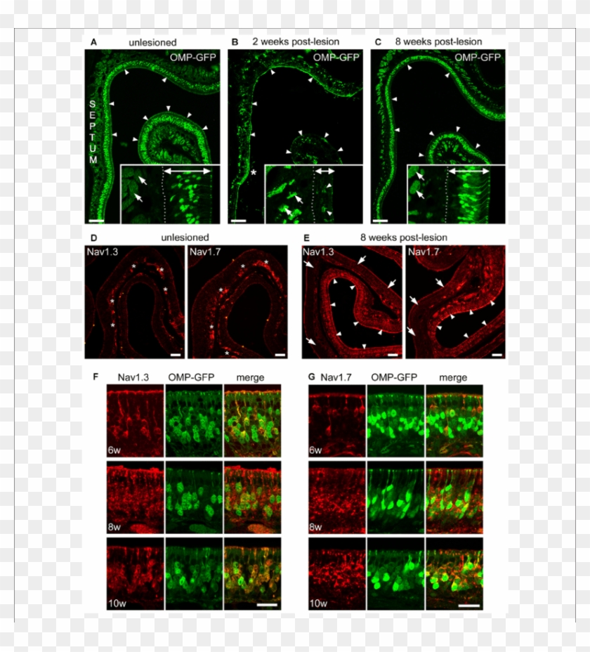 Recovery Of Na V - Graphic Design Clipart #3340573