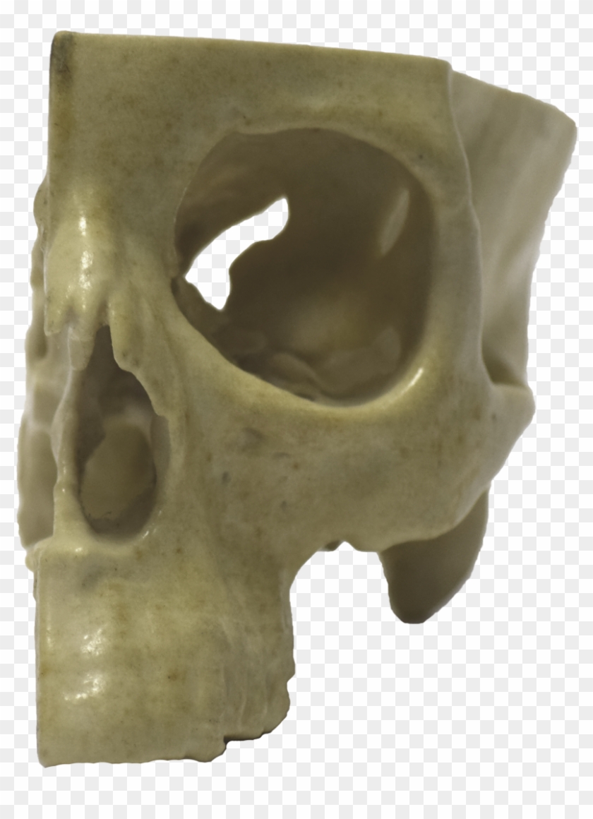 Front Of 3d Printed Half Skull - Skull Clipart #3419793