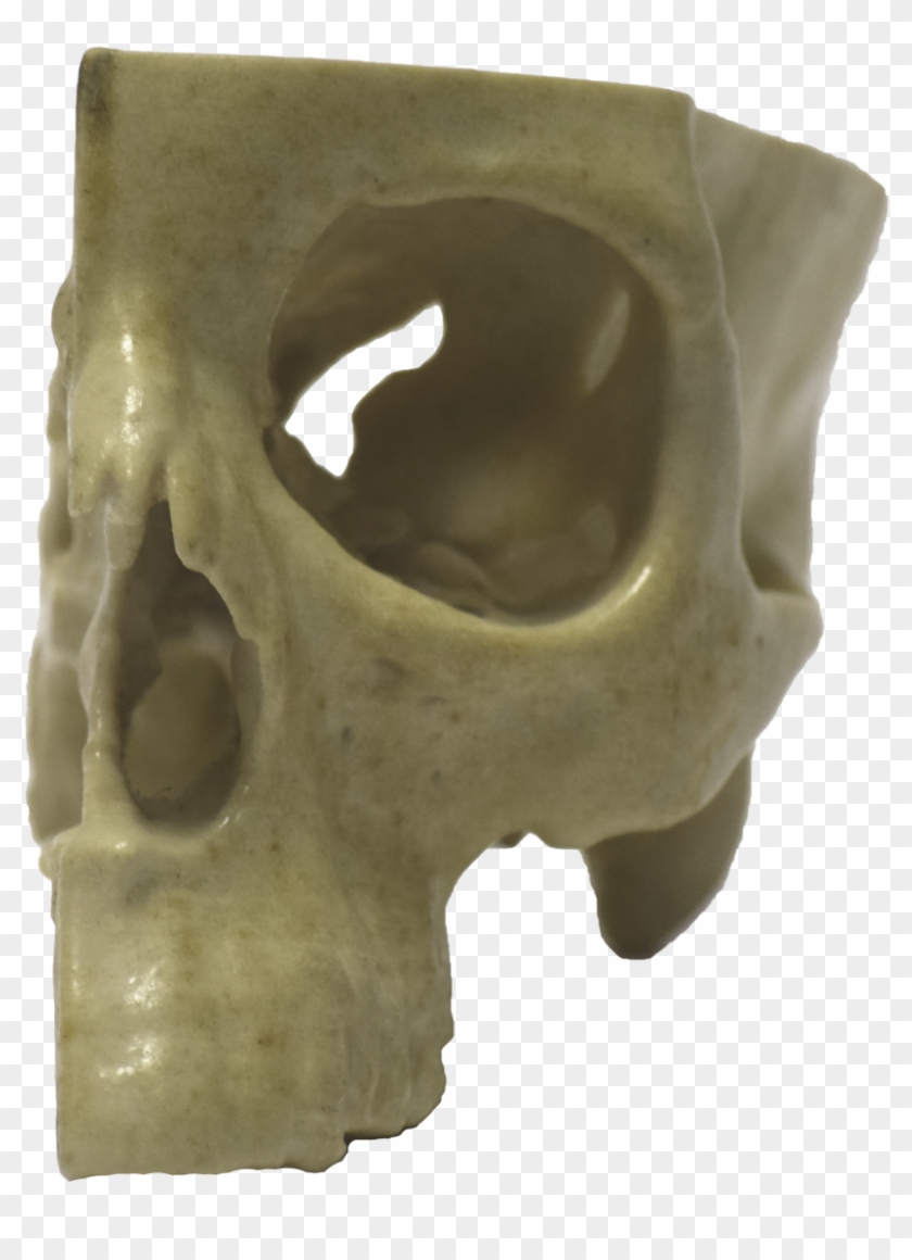 Front Of 3d Printed Half Skull - Skull Clipart