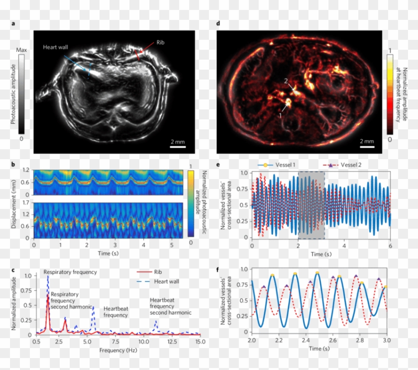 Label Free Imaging Of Small Animal Whole Body Dynamics - Computed Tomography Clipart #3476806