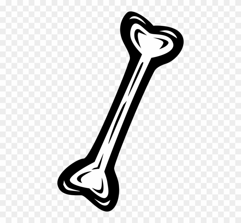 Vector Illustration Of Human Femur Bone Clipart #3481388