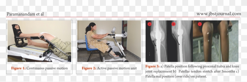 Largely Depends On The Bone And Joint Structure Loss - Computed Tomography Clipart