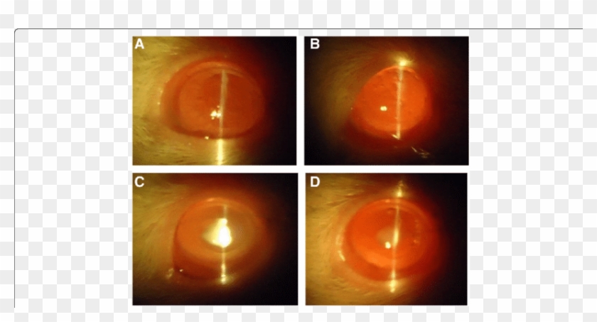 Slit Lamp Images Of Eyes - Light Clipart