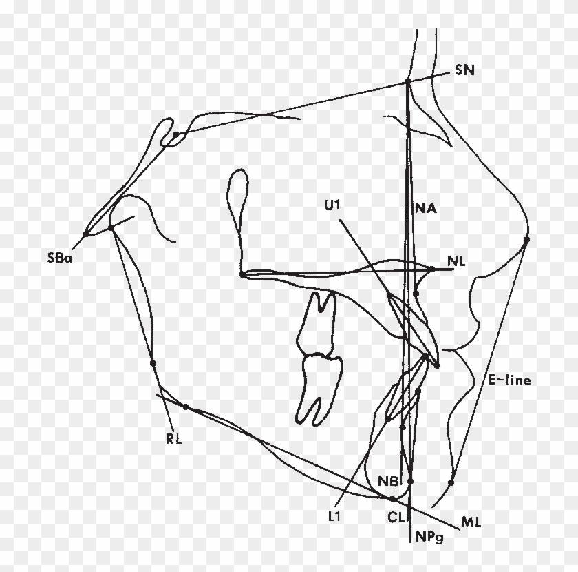 Graphic Transparent Library Cephalometric Reference - Aesthetic Line Clipart