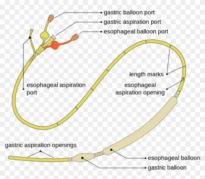 Sengstaken-blakemore Tube - Sengstaken Blakemore Tube Clipart #3514344