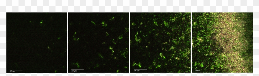 Fluorescence Microscopy Results - Chlorophyta Clipart #3515950
