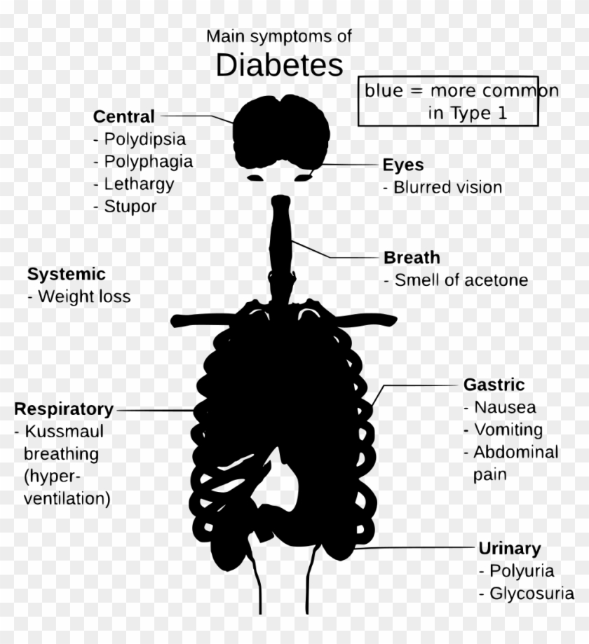 Download Png - Complications Of Diabetes Drawing Clipart