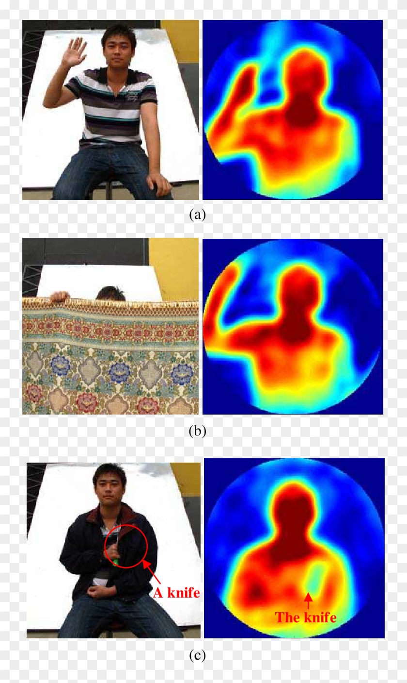 Imaging Results Of A Person - Computed Tomography Clipart #3568797