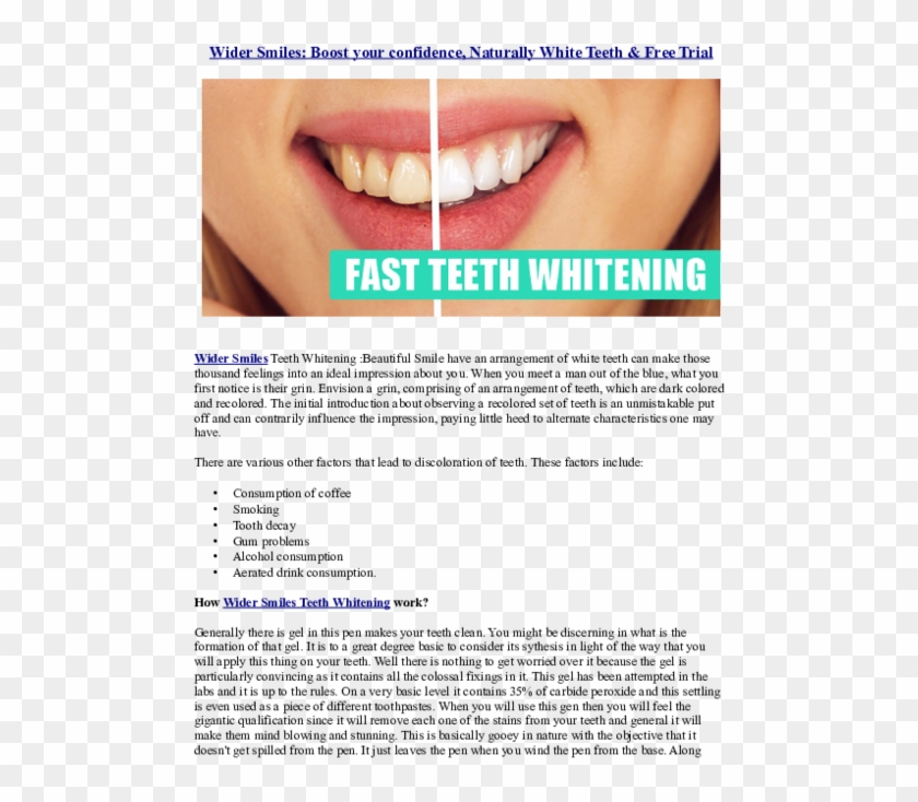 Pdf - Horse And The Depths: Artists' Books Clipart #3586521