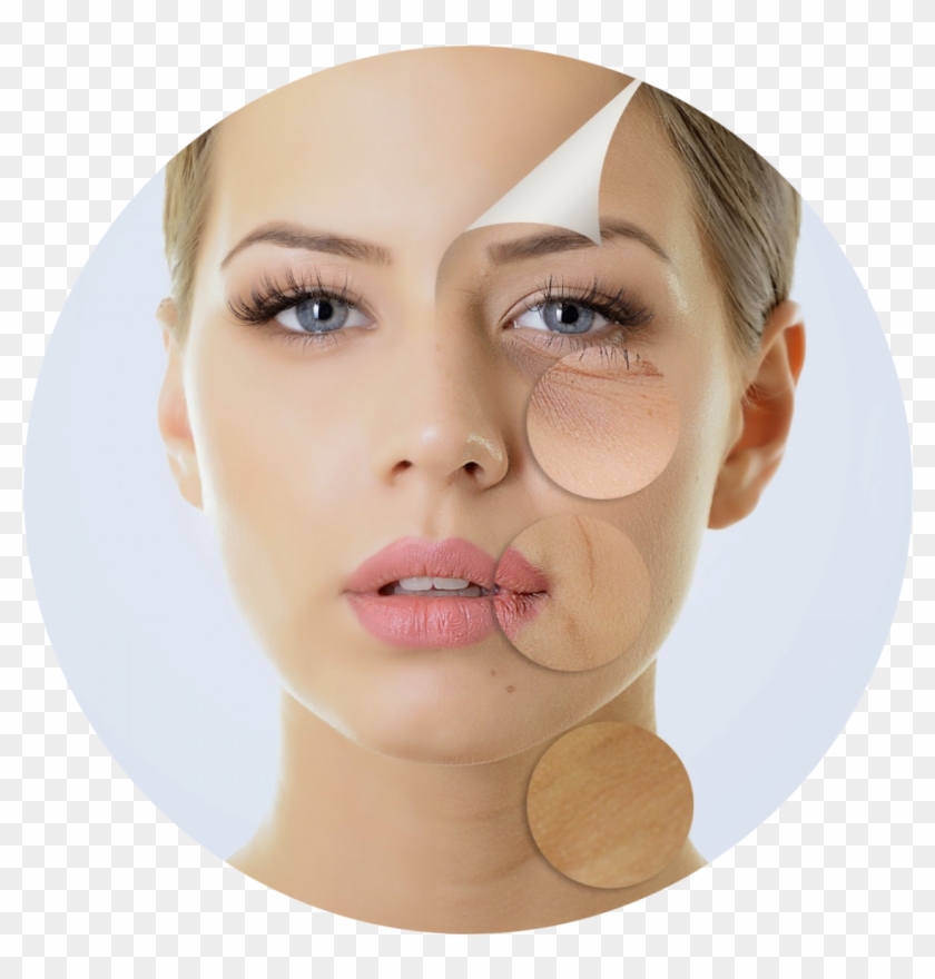 Kisspng Chemical Peel Skin Wrinkle Facial Exfoliation - Anti Age Procedūra Clipart #3595040