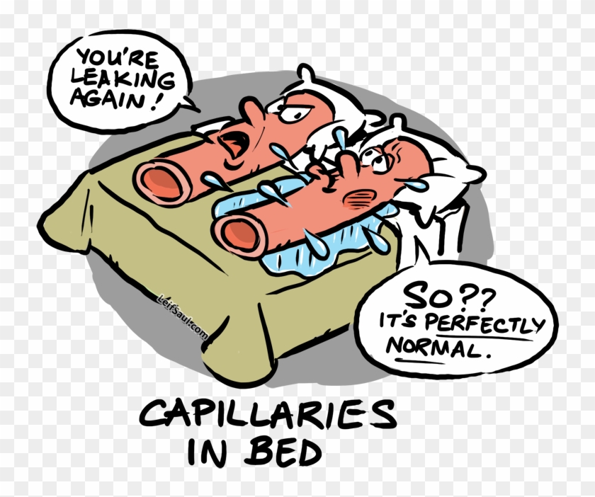 Capillaries Leaking In Bed - Cartoon Clipart #3613023
