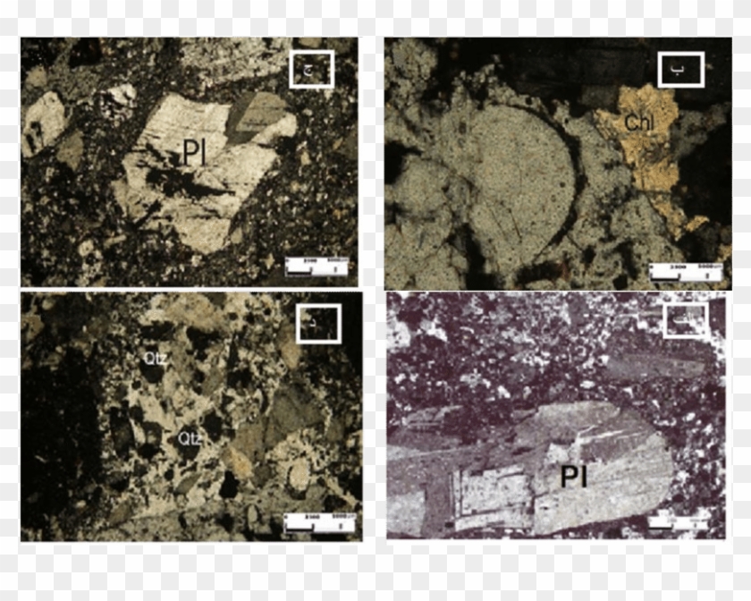 Microscopic Images Of The Textures Of Zone: A) Microcytic - Visual Arts Clipart