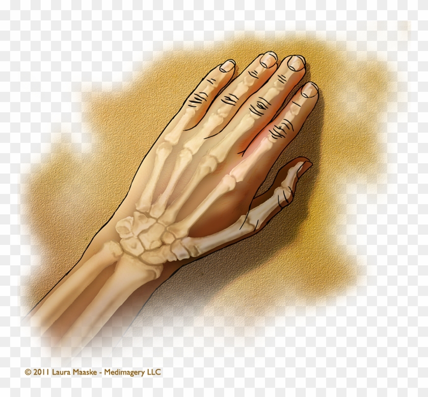 Tips For Artists Who Would Like Medical Illustration - Transparent Hand Anatomy Clipart