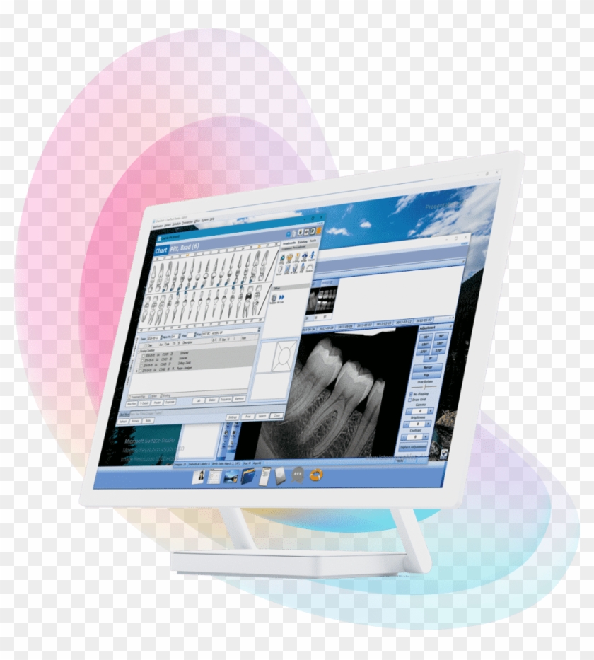 Your First Dental Software - Output Device Clipart #3649641