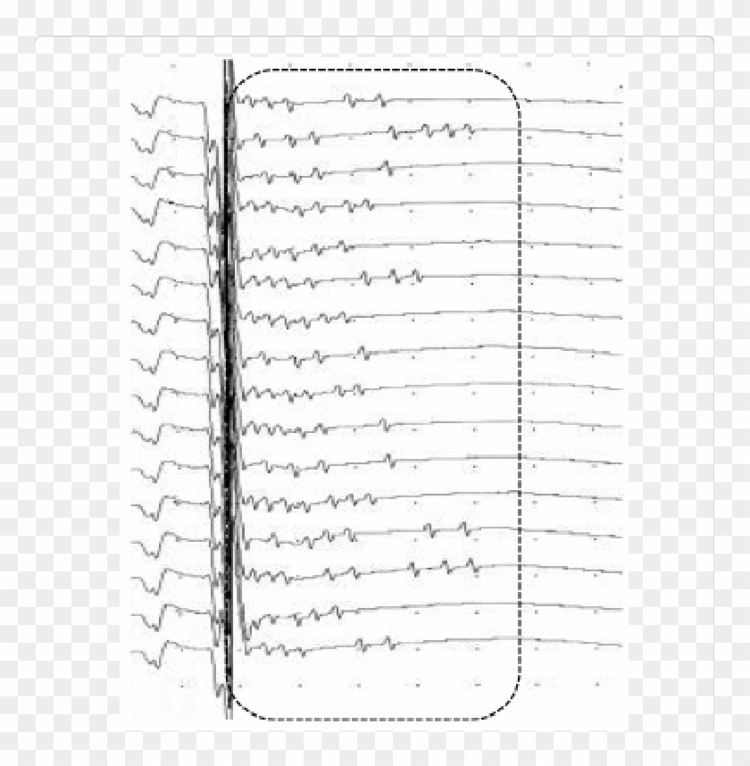 Amplitude Sensitivity - Paper Clipart