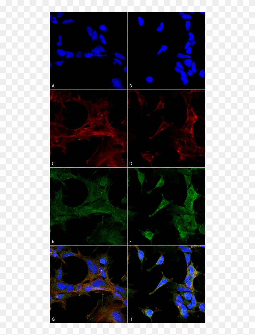 Smc 510 4 Hydroxy 2 Hexenal Antibody 6f10 Icc If Human - Laser Clipart