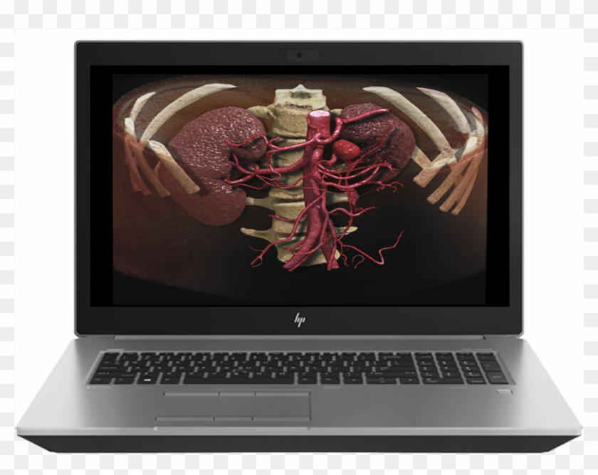 Mobile Workstation - Hp G5 17 Clipart