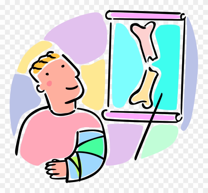 More In Same Style Group - Broken Arm X Ray Cartoon Clipart