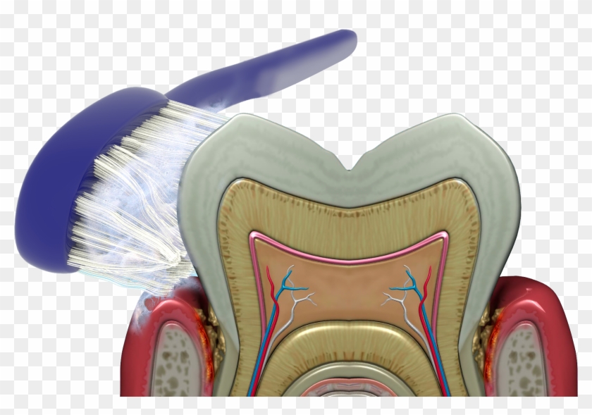 Brushing, Rinsing And Flossing Cannot Reach The Bacteria - Brush Clipart #3773630