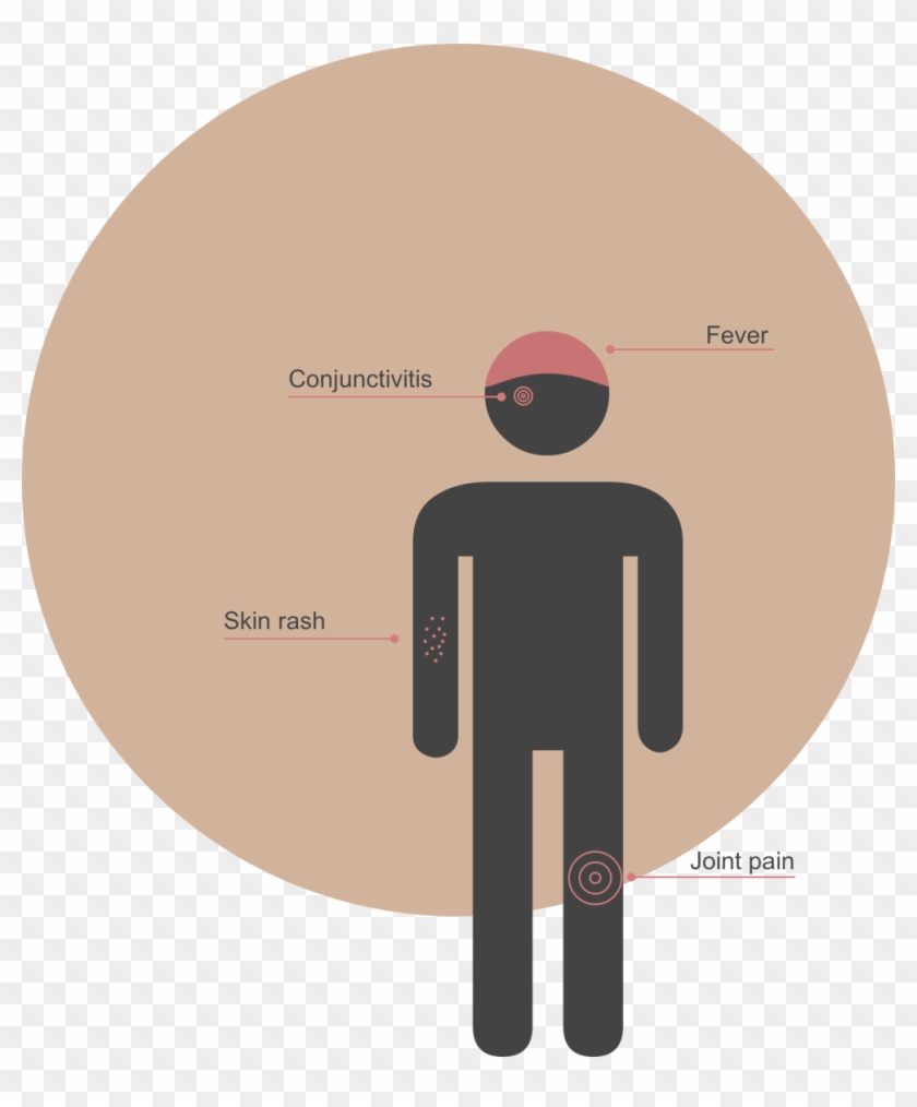 The World Health Organization Has Labeled The Zika - Wc Logo Man Vrouw Png Clipart