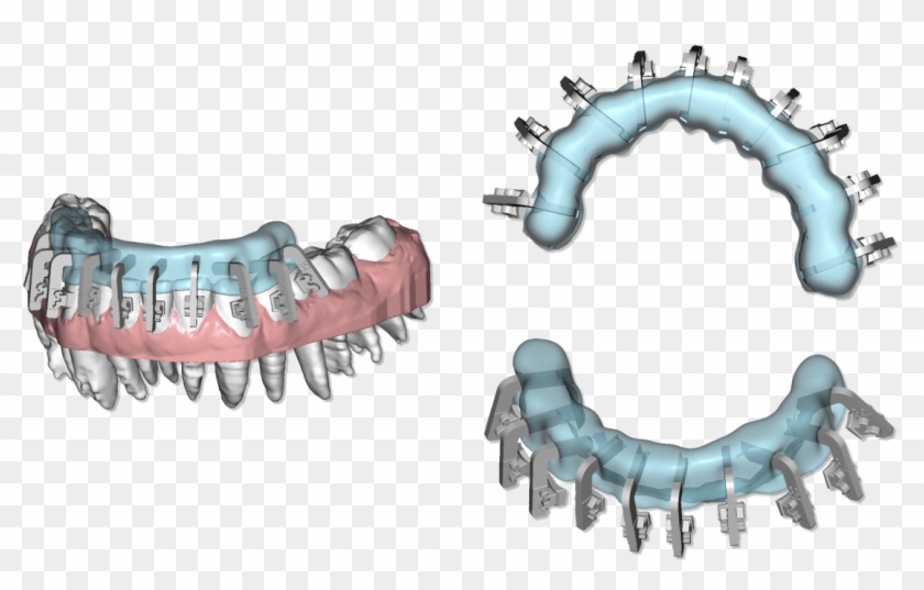 File - Maestro3d - Dental - Studio - Clear - Aligner - Maestro Ortho Clipart