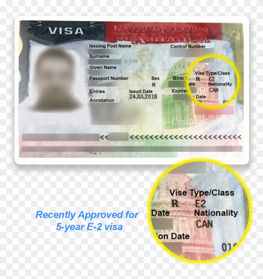 If At The Time Of The Interview, The Couple Has Been - Usa Visa Clipart