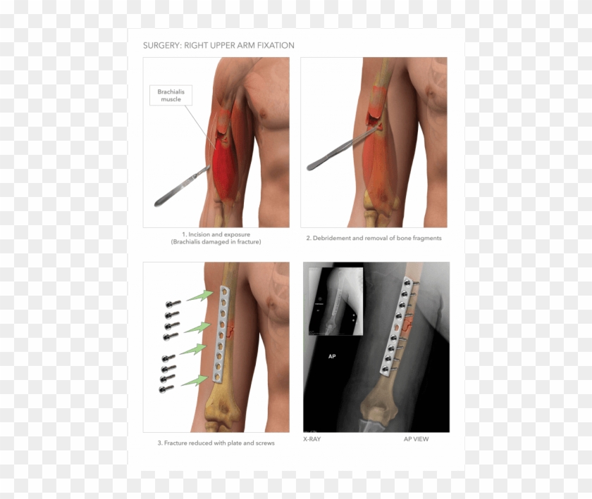 Strap Clipart #3831692