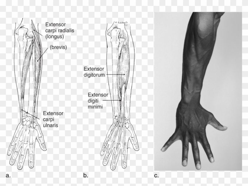 Image Not Available - Back Of Forearm And Hand Clipart