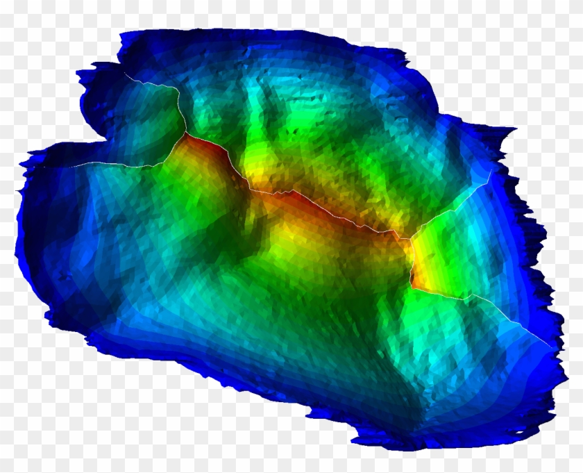 Individual Based Mitral Valve Finite Element Model - Art Clipart #3901203