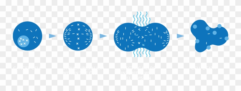 Ttf, Tumor Treating Fields - Tumor Treating Fields Clipart