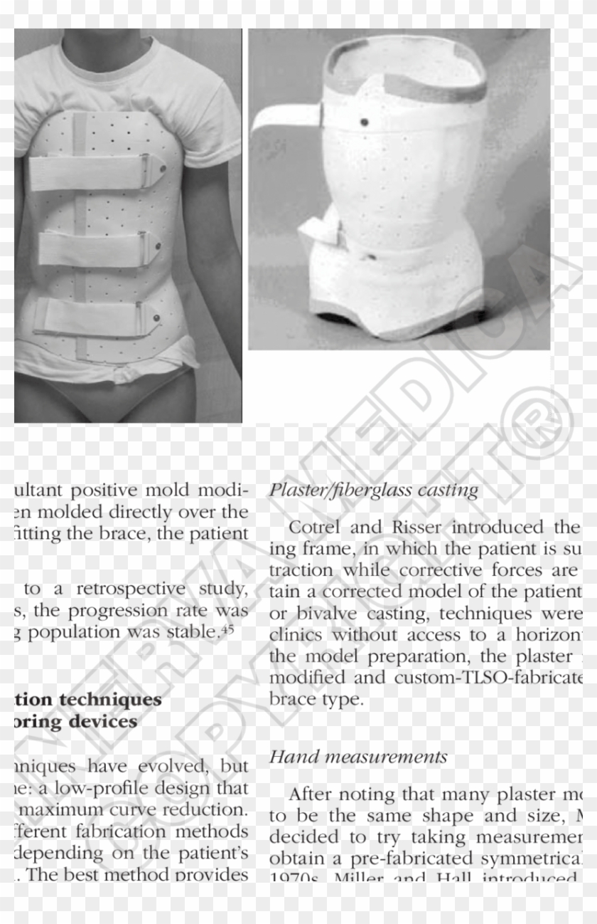 -wilmington Brace - - Wilmington Brace For Scoliosis Clipart #3985429