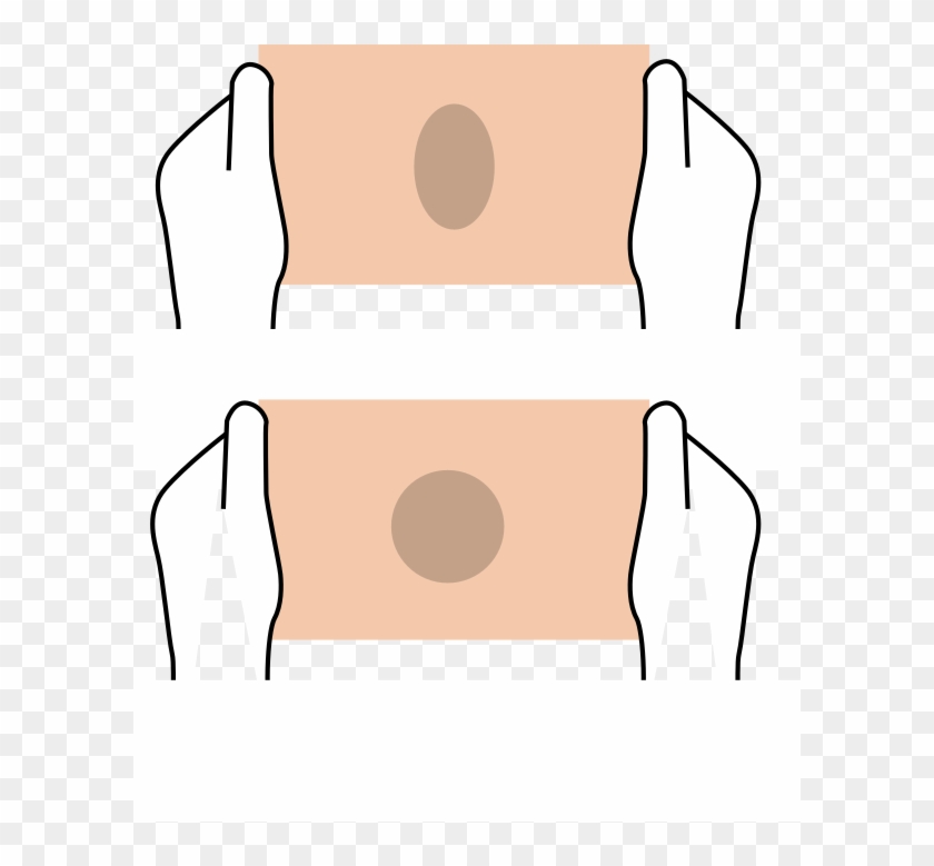 Correct Size Bandage, Correct Stretch Bandage - Illustration Clipart #46007