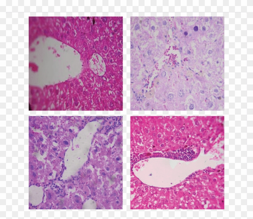 Effect Of Untreated And Selenium Treated Mscs On Histopathological - Whale Clipart #4023698
