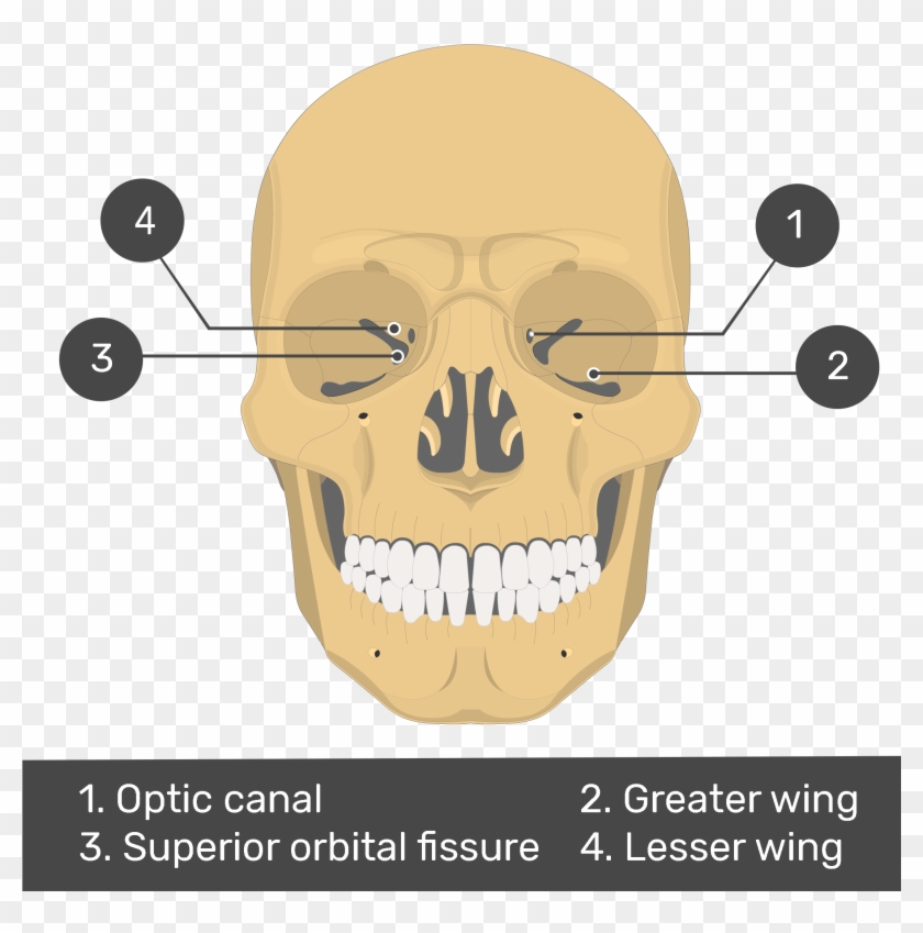 Download Anterior View Of The Sphenoid Bone Optic Canal Of Sphenoid