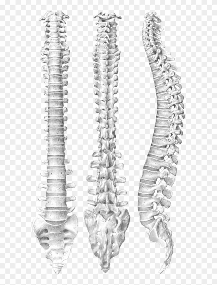 Spine Png - T4 To L1 Spinal Fusion Clipart #415909