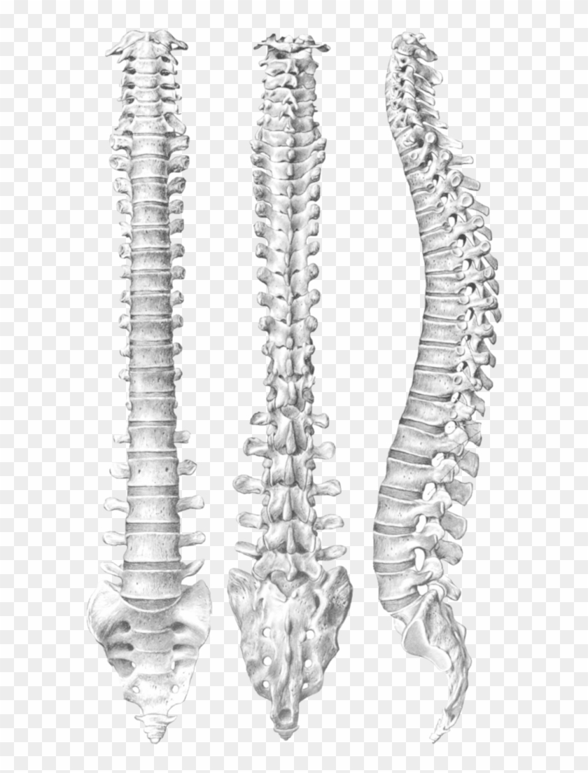 Spine Png - T4 To L1 Spinal Fusion Clipart #415909