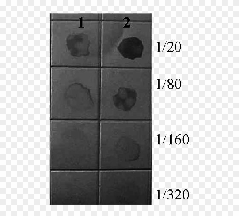 Inmunoensayo En Membrana De Nitrocelulosa Con Un Rango - Tile Clipart